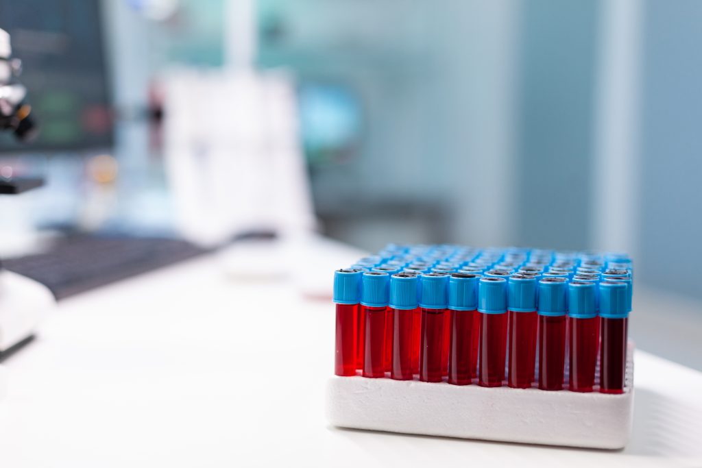 vacutainer medyczny z probka krwi stojaca na stole podczas badania farmaceutycznego