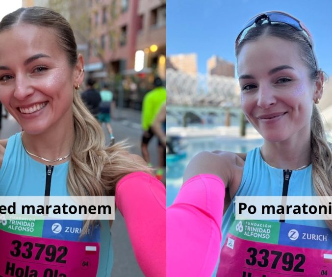 Runner’s Face - co to właściwie jest i czy naprawdę dotyczy biegaczy? 7 IMG 0799