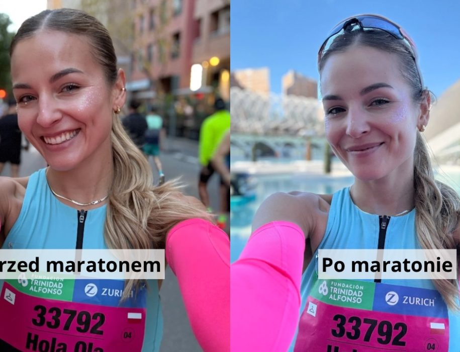 Runner’s Face - co to właściwie jest i czy naprawdę dotyczy biegaczy? 4 IMG 0799