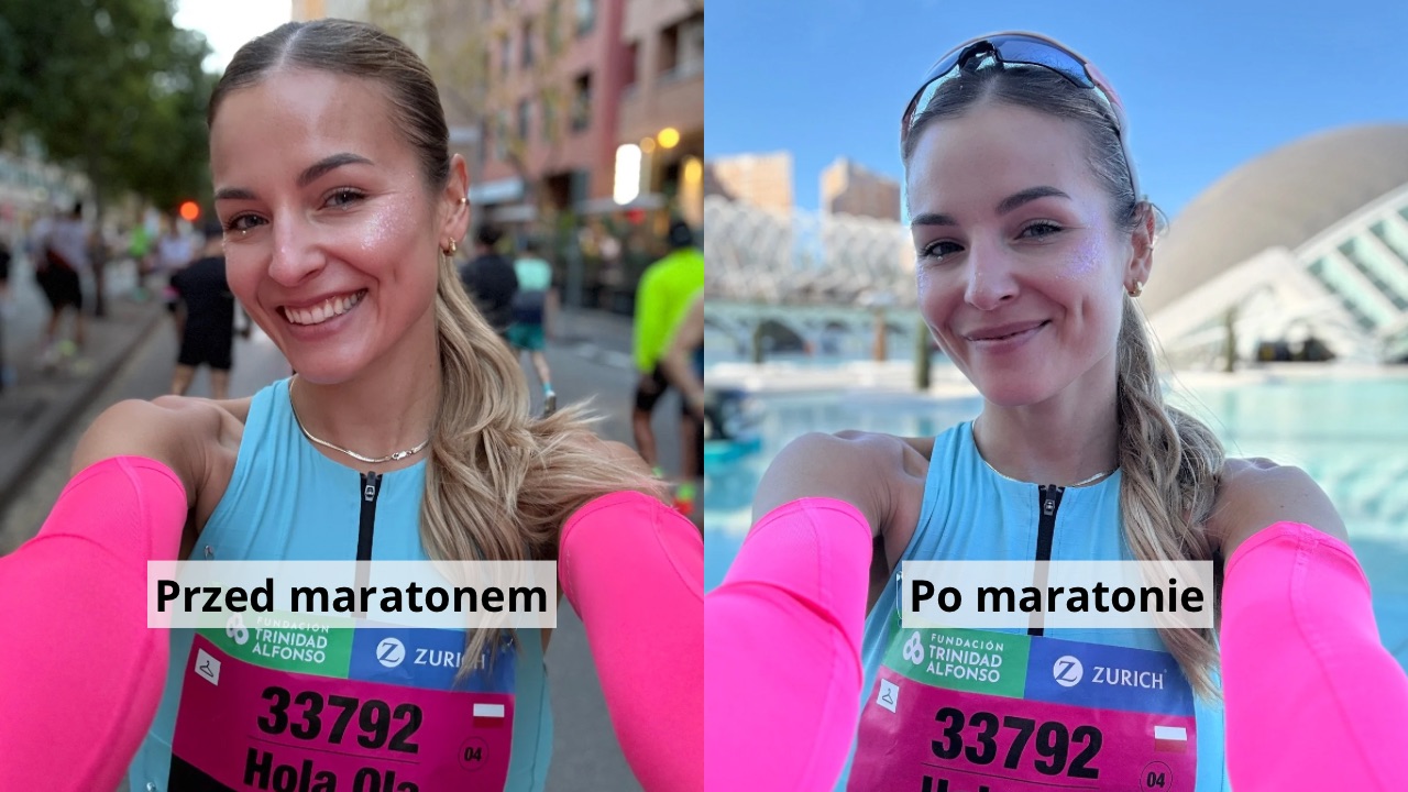 Runner’s Face – co to adekwatnie jest i czy naprawdę dotyczy biegaczy?